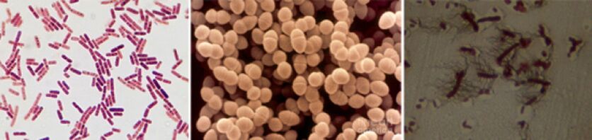 Escherichia Sticks, Enterococcus fécal et Pro - Les principaux agents pathogènes de la prostatite bactérienne chronique