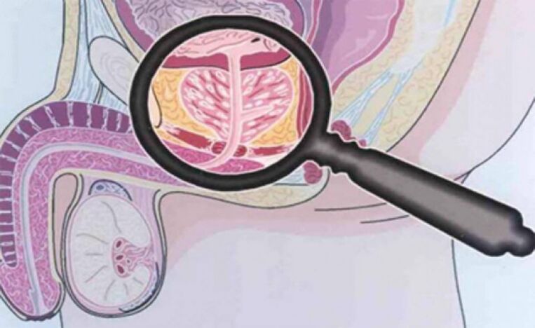 La prostate et son emplacement