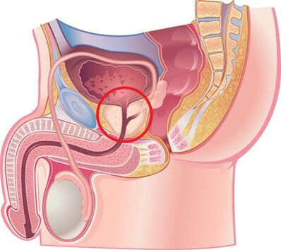 Localisation de la prostate chez l'homme